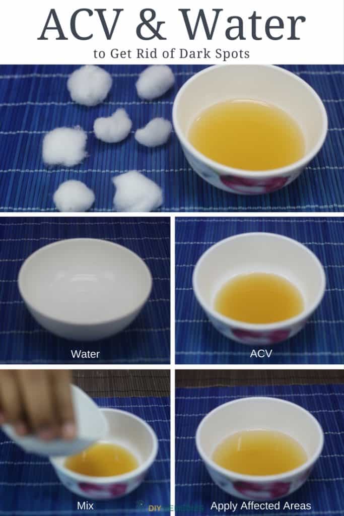 How to Get Rid of Dark Spots using Apple Cider Vinegar