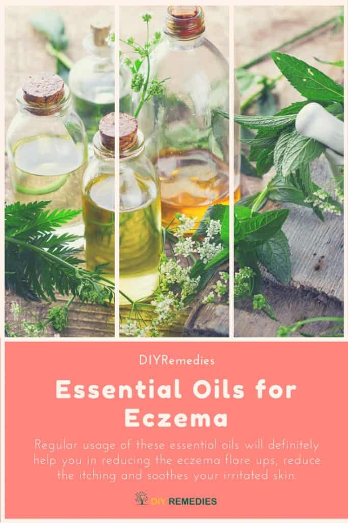 Essential Oils For Eczema