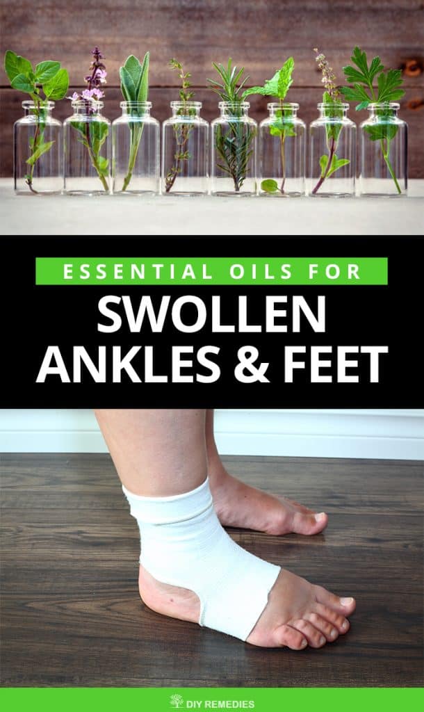 Best Ways to use Essential Oils for Swollen Ankles and Feet