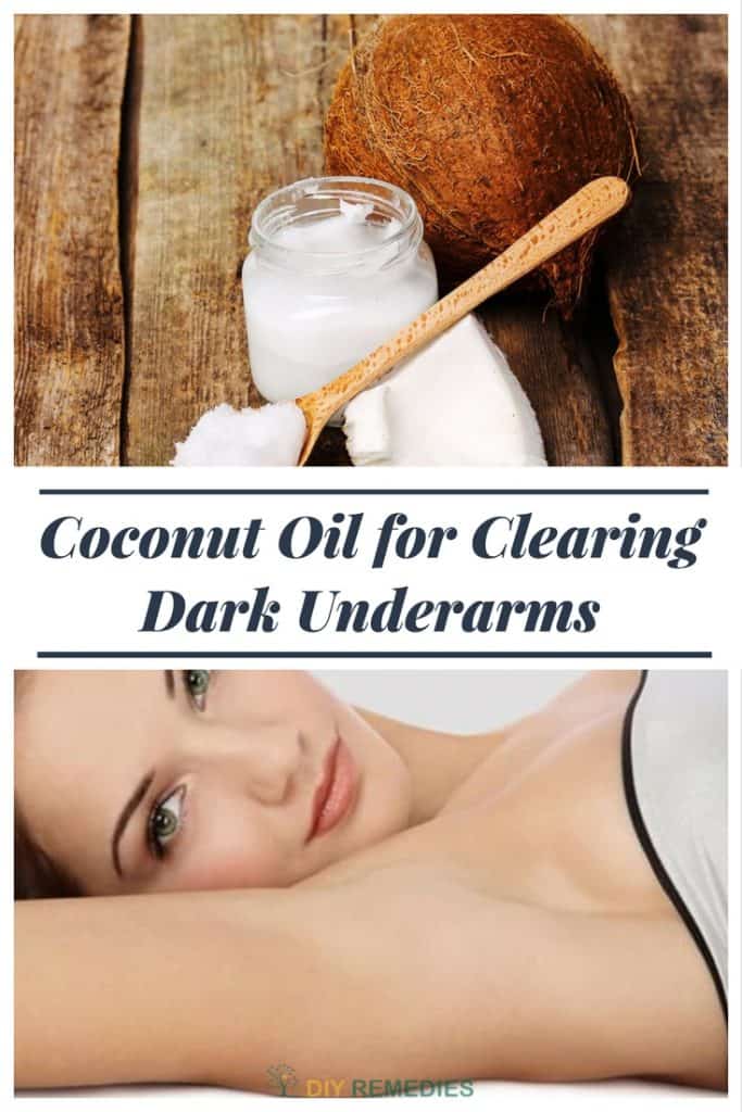 How to Lighten your Dark Underarms using Coconut Oil