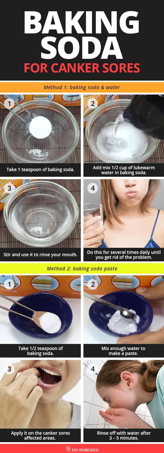 Home Remedies for Canker Sores