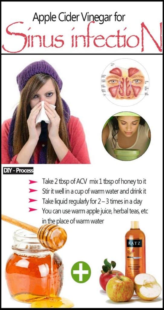 How To Clear Sinus Infection With Apple Cider Vinegar