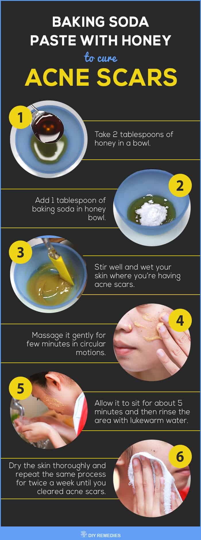 How to Get Rid of Acne Scars using Baking Soda