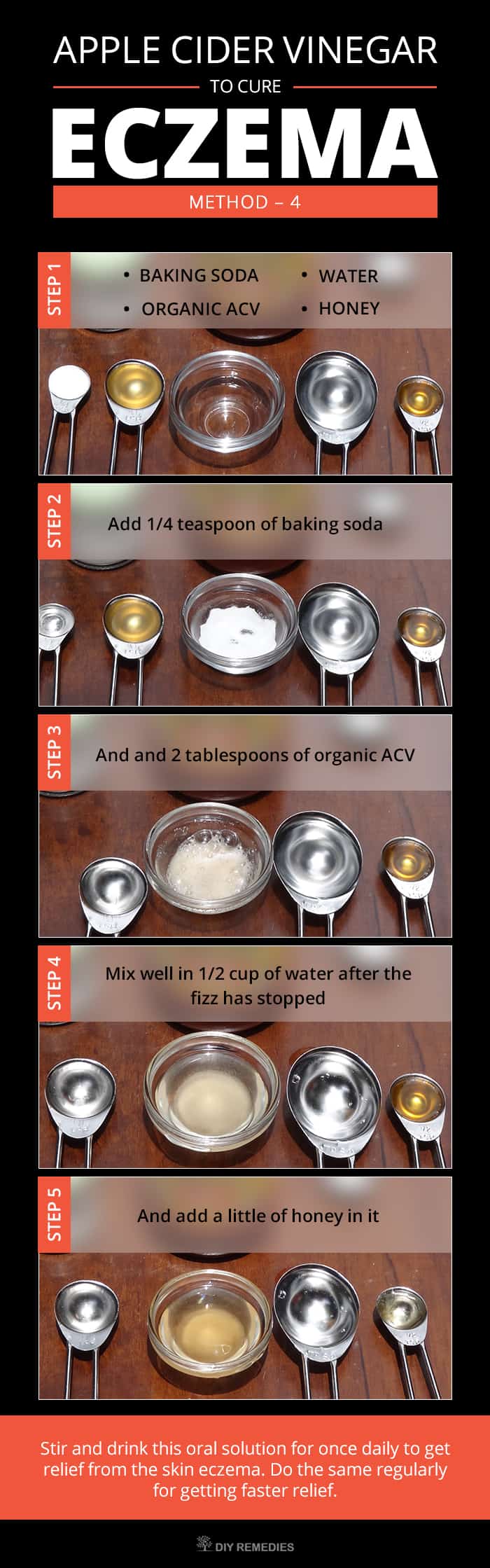 How to Get Rid of Eczema using Apple Cider Vinegar