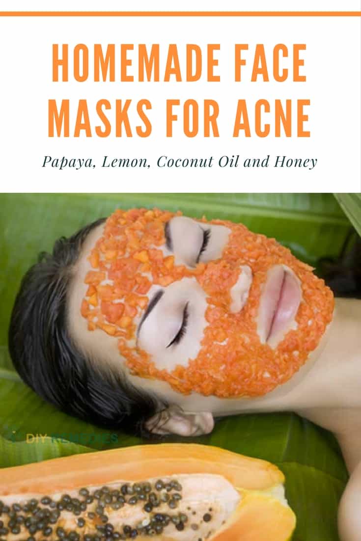 6 Best DIY Homemade Face Masks for Acne