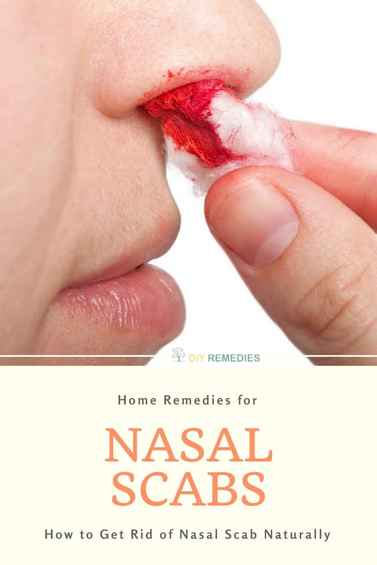 Home Remedies for Nasal Scabs