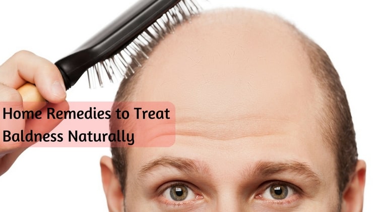 Home Remedies to Treat Baldness Naturally