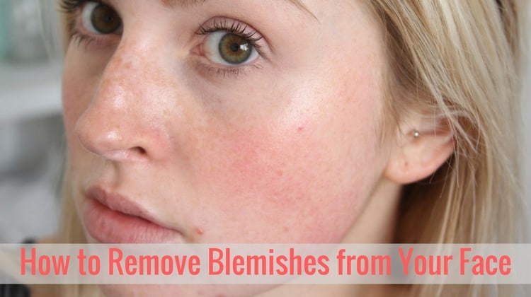 How to Remove Blemishes from Your Face