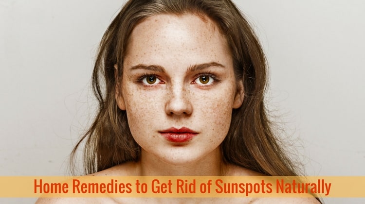 Home Remedies to Get Rid of Sunspots Naturally