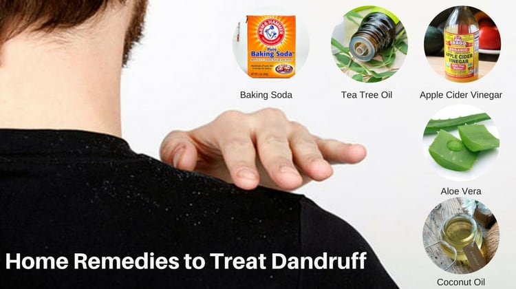 Home Remedies to Treat Dandruff