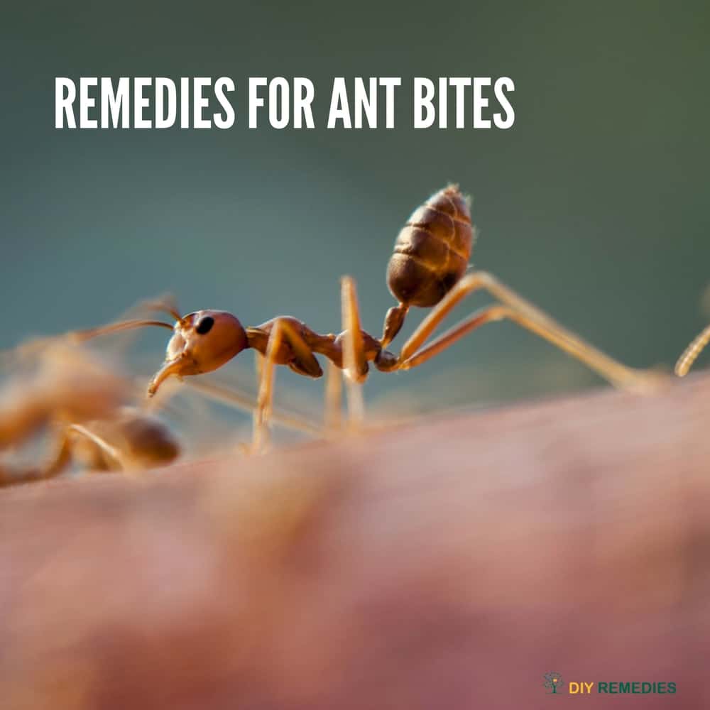 Remedies for Ant Bites