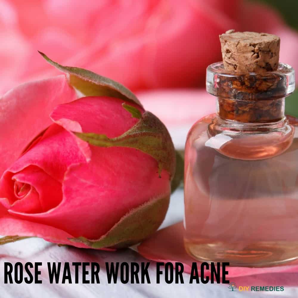 Rose Water Work for Acne